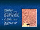 Navikas ir organizmo imunitetas, antigeninės navikų savybės, nesavitasis organizmo atsparumas navikams  5 puslapis