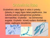 Dermatologija ir odos ligos 18 puslapis