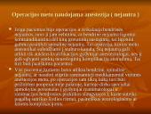 Pilvo sienos operacijos. Riebalų atsiurbimas iš įvairių kūno vietų 9 puslapis