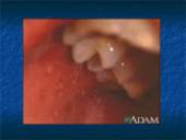 Tymų virusai 7 puslapis