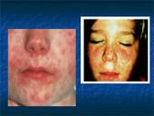 Tymų virusai 10 puslapis