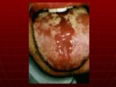 AIDS – pasaulio maras 16 puslapis