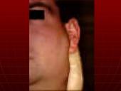 AIDS – pasaulio maras 17 puslapis