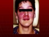 AIDS – pasaulio maras 19 puslapis