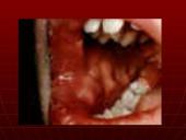 AIDS – pasaulio maras 20 puslapis