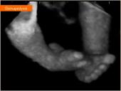 Akušerinė echoskopija 16 puslapis