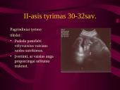 Akušerinė echoskopija 18 puslapis