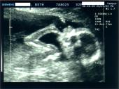 Akušerinė echoskopija 8 puslapis