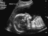 Akušerinė echoskopija 10 puslapis