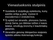 Audinių grupės 13 puslapis