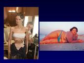 Dirbtinis maitinimas 11 puslapis