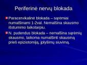 Gimdymo skausmo malšinimas 13 puslapis