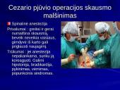 Gimdymo skausmo malšinimas 14 puslapis