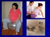 Gimdymo skausmo malšinimas 6 puslapis