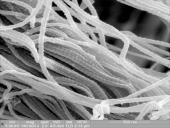 Kolageno tipai 11 puslapis