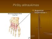 Pėdos kompleksas 19 puslapis