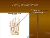Pėdos kompleksas 20 puslapis