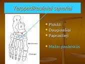 Pėdos kompleksas 7 puslapis