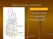 Pėdos kompleksas 9 puslapis