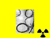 Radioaktyvios spinduliuotės poveikis gyvajam organizmui 11 puslapis