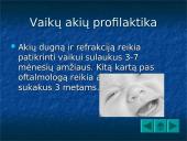 Regėjimas 4 puslapis