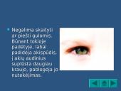 Regėjimas 9 puslapis