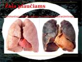 Rūkymas yra žalingas įprotis 8 puslapis