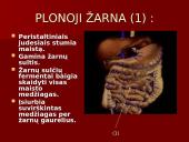 Žmogaus virškinimo sistema ir jos sandara 10 puslapis