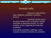 Anomalios raidos samprata 2 puslapis
