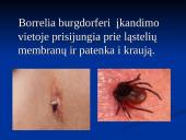 Borrelia burgdorferi 15 puslapis