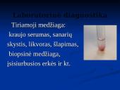 Borrelia burgdorferi 16 puslapis