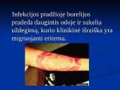 Borrelia burgdorferi 6 puslapis