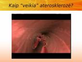 Cholesterolis. Aterosklerozė. Išeminė širdies liga 12 puslapis