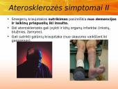 Cholesterolis. Aterosklerozė. Išeminė širdies liga 15 puslapis