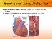 Cholesterolis. Aterosklerozė. Išeminė širdies liga 20 puslapis