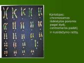 Chromosoma 9 puslapis