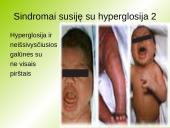 Hyperglosija ir hypoglosija 14 puslapis