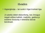 Hyperglosija ir hypoglosija 18 puslapis