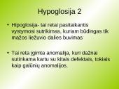 Hyperglosija ir hypoglosija 7 puslapis