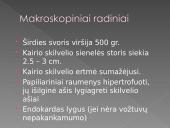 Hipertenzinė širdies liga 16 puslapis