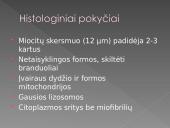 Hipertenzinė širdies liga 17 puslapis