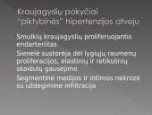 Hipertenzinė širdies liga 20 puslapis