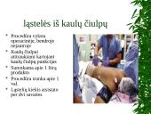 Kaulų čiulpų transplantacija 13 puslapis