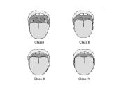 Ligonio paruošimas anestezijai 14 puslapis