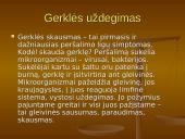 Populiariausios ligos Ignalinos rajano gimnazijoje 6 puslapis