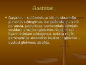 Populiariausios ligos Ignalinos rajano gimnazijoje 8 puslapis