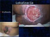 Pragulos ir jų gydymas 11 puslapis