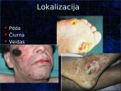 Pragulos ir jų gydymas 12 puslapis