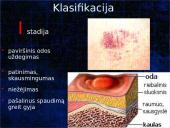 Pragulos ir jų gydymas 14 puslapis