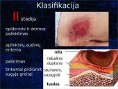 Pragulos ir jų gydymas 15 puslapis